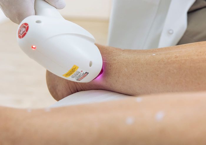 Haarentfernung mit DHR/FDHR Diodenlaser Altona Haarentfernung mit DHR/FDHR Diodenlaser Altona